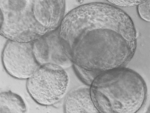 B/w microscope image of pancreas organoids of different sizes. They are round and hollow.