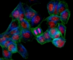 Gene befinden sich auf der Erbsubstanz im Zellkern. Auf diesem Foto sind die Zellkerne rot angefärbt.