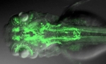 The photo shows a microscopic picture of the zebrafish nervous system.