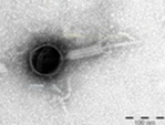 Electron microscope image of a bacteriophage.