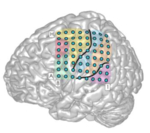 Zu sehen ist ein Schema eines Gehirns, auf dem Elektroden in einem Koordinatensystem angeordnet sind.