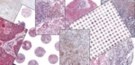 Collage of different technologies used by the tissue bank.