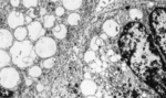 riesenmitochondrien.jpg