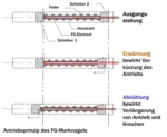 Zu sehen ist eine Schemazeichnung des Antriebsprinzips, die darstellt, wie durch das Einrasten zweier Schieber eine Erwärmung die Verkürzung des Antriebs und eine Abkühlung die Verlängerung von Antrieb und Knochen bewirkt.