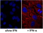 Zwei gegenübergestellte mikroskopische Aufnahmen von Fibroblasten einer MxA-transgenen Maus. Rechts: Zellkerne der Fibroblasten. Links: Durch die Behandlung mit Alpha-Interferon bildeten sich MxA-Proteine, welche die Zellkerne nun umgeben.
