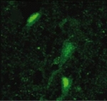 Neurone aus dem Hippocampus - grün markiert ist die Zunahme des Androgenrezeptors zu sehen.