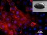 Microscope image of several orange cells; the photo in the top right shows a droplet of liquid.<br />