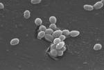 Enterococcus faecalis, a bacterium that frequently occurs in hospitals, seen under the electron microscope.