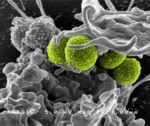 Electron microscope image of MRSA bacteria: four green spheres surrounded by grey cellular material.