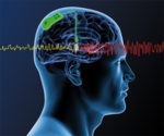 Schematic of a human head and brain containing an implant that sends signals to the right and left.<br />