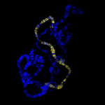 Vor schwarzem Hintergrund ist ein gelb leuchtendes Chromosom zwischen blau gefärbten Chromosomen sichtbar.