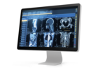 The photo shows a monitor with six radiological images.