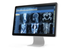 Es ist ein Monitor mit sechs radiologischen Bildern zu sehen.