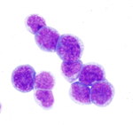 Das Bild zeigt einzelne hämatopoetische, also blutbildende Stammzellen. Sie besitzen eine rundliche Form, sind in dieser Aufnahme von einer gräulichen Zellmembran umschlossen und von lilalener Farbe.