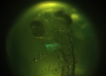 Foto einer transgenen Stichlingslarve mit grün leuchtendem Herzen.