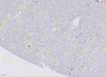 Microscope image of a kidney section, marked with yellow circles.