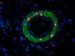 Zu sehen ist ein grüner Ring vor einem violetten Hintergrund. Der Ring ist durchsetzt mit roten Punkten.