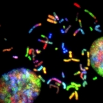 Electron micrograph of fluorescence-stained chromosomes