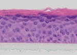 A histological section of human skin showing the different layers of the epidermis, including the keratinizing squamous epithelium