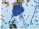 Aspergillus flavus (green mold)