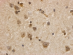 Huntington_Eiweiss_Abb_Dr_Katrin_Lindenberg_Neurologie_UK_Ulm.jpg