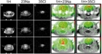 Kombinierte Protonen, Natrium und Chlorid MRT. Das Bild zeigt drei Schichtaufnahmen am Kopf eines Versuchtieres (Ratte), gemessen mit einem hochauflösenden 9,4 Tesla MRT-Gerät. <br /> (a) Morphologische Protonen-Bilder, (b) Natrium-Bilder, (c) Chlorid-Bilder; (d+e) Überlagerung der Natrium- (d) bzw. Chlorid- (e) Bilder mit den jeweiligen Protonen-Bildern.<br />