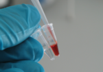 Eine Hand mit Pipette führt die Farbreaktion in zwei Reaktionsgefäßen durch: Im ersten Gefäß ist der Reaktionsansatz noch farblos, im zweiten rot gefärbt.