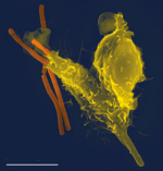 The photo shows a greenish-yellowish cell against a dark blue background; three red rods are located close to the cell.<br />