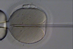 In-Vitro-Fertillisation: Bei der intrazytoplasmatischen Spermieninjektion wird das Spermium mit einer Pipette in die mittels einer Haltepipette fixierte Eizelle eingebracht.