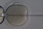 In-Vitro-Fertillisation: Bei der intrazytoplasmatischen Spermieninjektion wird das Spermium mit einer Pipette in die mittels einer Haltepipette fixierte Eizelle eingebracht.