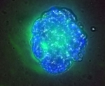 Fluorescence microscope image showing the degradation of the proteins.