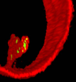 Zu sehen ist eine dreidimensionale mikroskopische Darstellung eines künstlichen Vesikels, der von Bakterien invasiert wird.