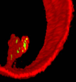 Three-dimensional microscopic representation of a synthetic vesicle that is invaded by bacteria.