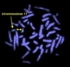 Chromosomen, besonders Chr. 17 ohne Liss1