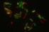 Teaser: E. coli Ribosomen Markierung Elke Deuerling Uni Konstanz