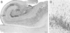 Menschlicher Hippocampus_Teaser