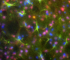 Neuronale Stammzellen