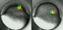 Zebrafischembryo Teaser