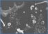 HIV-Partikel, an Zellmembran geheftet.