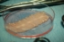 Luftröhre / trachea patch