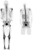 Leukaemiezellen_aktiv_PET_CT