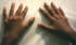 Arthritis Hand