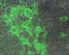 Tollwut_Virus_Infizierte_Zellen