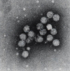HCV_particles_EM.jpg