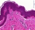Histologisches Bild der Haut Teaser