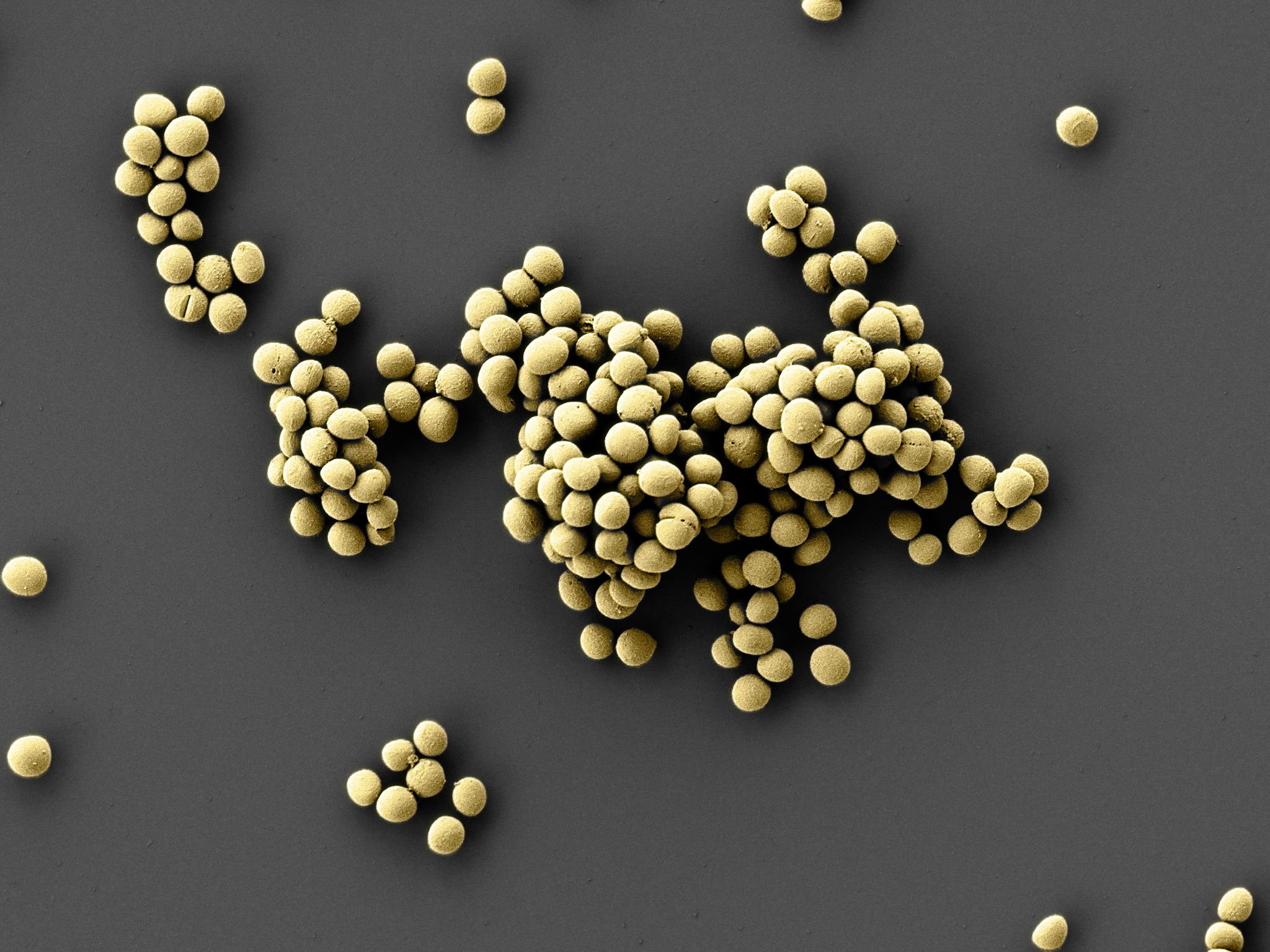 Colonies of the germ as beige-coloured spheres on a dark grey background.